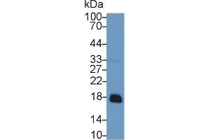 Western blot analysis of Rat Liver lysate, using Rabbit Anti-Rat ACP1 Antibody (1 µg/ml) and HRP-conjugated Goat Anti-Rabbit antibody (abx400043, 0. (ACP1 anticorps  (AA 1-158))