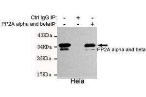 Immunoprecipitation analysis of Hela cell lysates using A alpha and beta mouse mAb. (PP2A alpha/beta anticorps)