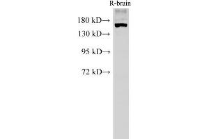 Western Blot analysis of Rat brain tissue using PARD3A Polyclonal Antibody at dilution of 1:500 (PARD3 anticorps)