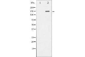 Western blot analysis of Trk B phosphorylation expression in Mouse kidneytissue lysates,The lane on the left is treated with the antigen-specific peptide.