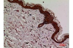 Immunohistochemistry (IHC) analysis of paraffin-embedded Human Skin, antibody was diluted at 1:100.