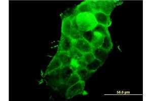 Immunofluorescence of monoclonal antibody to PDLIM5 on A-431 cell.