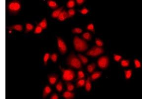 Immunofluorescence analysis of A549 cells using MLF1 Polyclonal Antibody (MLF1 anticorps)