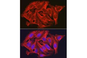 Immunofluorescence analysis of U2OS cells using D Rabbit pAb (ABIN6134076, ABIN6139403, ABIN6139404 and ABIN6224222) at dilution of 1:250 (40x lens). (DAPK2 anticorps  (C-Term))