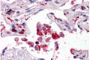 Human Lung (formalin-fixed, paraffin-embedded) stained with AIF1 antibody ABIN337364 at 5 ug/ml followed by biotinylated anti-goat IgG secondary antibody ABIN481715, alkaline phosphatase-streptavidin and chromogen. (Iba1 anticorps  (AA 149-161))