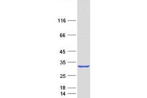 Validation with Western Blot