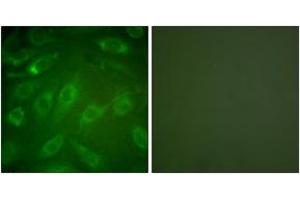 Immunofluorescence analysis of NIH-3T3 cells, using Collagen I Antibody. (Collagen Type I anticorps  (AA 1-50))