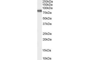 Western Blotting (WB) image for anti-Family with Sequence Similarity 124A (FAM124A) (C-Term) antibody (ABIN2791018) (FAM124A anticorps  (C-Term))