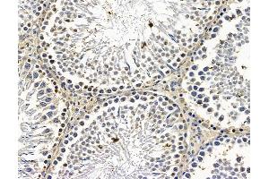 ABIN7096614 and ABIN7100678 at 1/100 staining rat testis tissue by IHC-P. (MON1A anticorps)