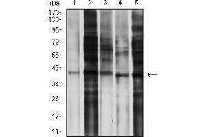 Western blot analysis using CD195 mouse mAb against MOLT4 (1), L-02 (2), SPA-C-1 (3), A549 (4), and C6 (5) cell lysate.