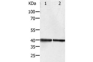 Western Blot analysis of Hela and Jurkat cell using PDX1 Polyclonal Antibody at dilution of 1:450 (PDX1 anticorps)