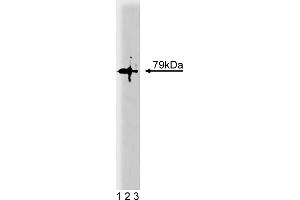 Western Blotting (WB) image for anti-Protein Kinase C, theta (PRKCQ) (AA 21-217) antibody (ABIN967739)