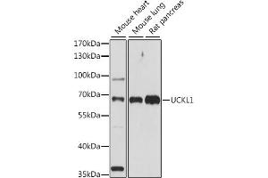 Western blot analysis of extracts of various cell lines, using UCKL1 antibody (ABIN7271233) at 1:1000 dilution. (UCKL1 anticorps  (AA 1-200))