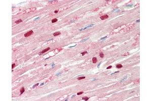 Human, Heart: Formalin-Fixed Paraffin-Embedded (FFPE).