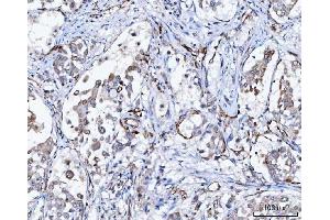 IHC analysis of SLC9A3R2 using anti-SLC9A3R2 antibody (ABIN7599271).