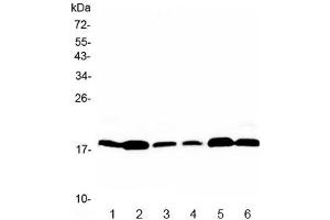 Western blot testing of rat 1) brain, 2) heart, 3) kidney and moouse 4) brain, 5) heart, 6) kidney with MED9 antibody at 0. (MED9 anticorps)