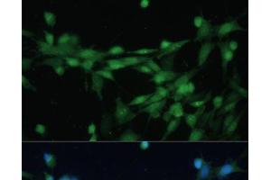 Immunofluorescence analysis of NIH-3T3 cells using CSNK2B Polyclonal Antibody at dilution of 1:100 (40x lens).
