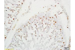 Formalin-fixed and paraffin embedded rat testis labeled with Anti-SOX9/SRA1 Polyclonal Antibody, Unconjugated (ABIN754963) at 1:200 followed by conjugation to the secondary antibody and DAB staining