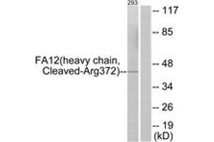 Western blot analysis of extracts from 293 cells, treated with etoposide 25uM 1h, using FA12 (heavy chain,Cleaved-Arg372) Antibody. (F12 anticorps  (Cleaved-Arg372))