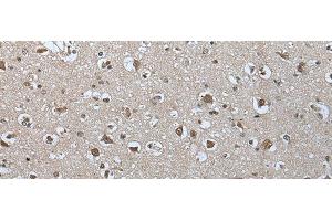 Immunohistochemistry of paraffin-embedded Human brain tissue using USP35 Polyclonal Antibody at dilution of 1:55(x200) (USP35 anticorps)