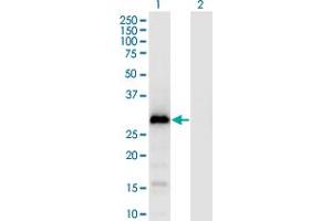 Western Blot analysis of GAGE1 expression in transfected 293T cell line by GAGE1 monoclonal antibody (M04), clone 4G6.