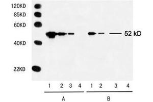 Multiple Tag Cell Lysate (ABIN1536505) Primary antibody: A. (Myc Tag anticorps)