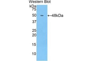 Detection of Recombinant COL14, Human using Polyclonal Antibody to Collagen Type XIV (COL14) (COL14A1 anticorps  (AA 1280-1461))
