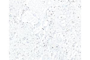 Immunohistochemistry (IHC) image for anti-Achaete-Scute Complex Homolog 1 (Drosophila) (ASCL1) (AA 186-236) antibody (ABIN7455113) (Recombinant ASCL1 anticorps  (AA 186-236))