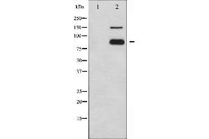 Western blot analysis of PECAM-1 phosphorylation expression in Jurkat whole cell lysates,The lane on the left is treated with the antigen-specific peptide. (CD31 anticorps  (pTyr713))