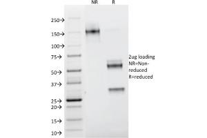 SDS-PAGE Analysis Purified Galectin-1 Monospecific Mouse Monoclonal Antibody (GAL1/1831).