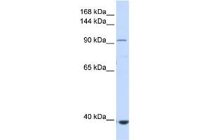WB Suggested Anti-IFIH1 Antibody Titration:  0. (IFIH1 anticorps  (Middle Region))