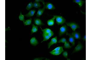 Immunofluorescence staining of A549 cells with ABIN7149328 at 1:100, counter-stained with DAPI. (CYFIP1 anticorps  (AA 320-449))