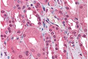 Human Kidney (formalin-fixed, paraffin-embedded) stained with ATM antibody ABIN213900 at 1-2 ug/ml followed by biotinylated goat anti-rabbit IgG secondary antibody ABIN481713, alkaline phosphatase-streptavidin and chromogen. (ATM anticorps  (C-Term))
