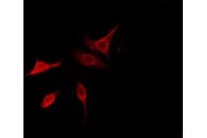 ABIN6278556 staining HeLa by IF/ICC.