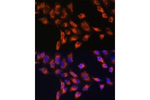 Immunofluorescence analysis of HeLa cells using SERPING1 antibody ( ABIN3022429, ABIN3022430, ABIN3022431 and ABIN6218816) at dilution of 1:100.