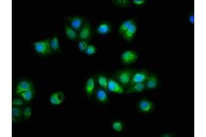 Immunofluorescence staining of HepG2 cells with ABIN7172220 at 1:100, counter-stained with DAPI.