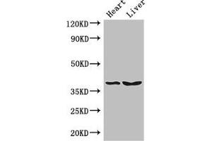 Western Blot Positive WB detected in: Mouse heart tissue, Mouse liver tissue All lanes: CTSB antibody at 3 μg/mL Secondary Goat polyclonal to rabbit IgG at 1/50000 dilution Predicted band size: 38 kDa Observed band size: 38 kDa (Cathepsin B anticorps  (AA 82-333))