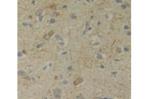 IHC-P analysis of Human Tissue, with DAB staining.