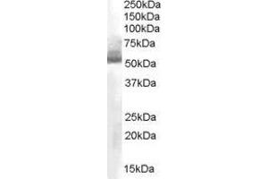 Image no. 1 for anti-Aldehyde Dehydrogenase 1 Family, Member A1 (ALDH1A1) (C-Term) antibody (ABIN374078) (ALDH1A1 anticorps  (C-Term))