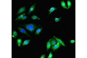 Immunofluorescent analysis of A549 cells using ABIN7152056 at dilution of 1:100 and Alexa Fluor 488-congugated AffiniPure Goat Anti-Rabbit IgG(H+L)