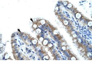 Immunohistochemical staining (Formalin-fixed paraffin-embedded sections) of human intestine with MECOM polyclonal antibody . (MECOM anticorps  (AA 964-1013))