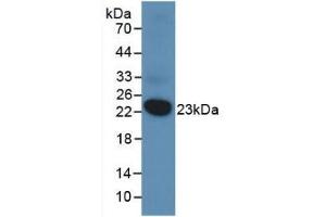 Detection of Recombinant DUSP3, Human using Monoclonal Antibody to Dual Specificity Phosphatase 3 (DUSP3) (Dual Specificity Phosphatase 3 (DUSP3) (AA 2-185) anticorps)