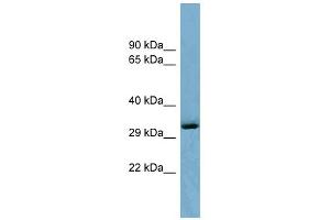 WB Suggested Anti-OTUD6B Antibody Titration: 0. (OTUD6B anticorps  (Middle Region))