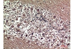 Immunohistochemistry (IHC) analysis of paraffin-embedded Human Brain, antibody was diluted at 1:100. (Prolactin anticorps  (Internal Region))
