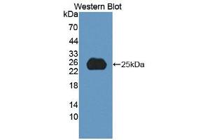 Western blot analysis of recombinant Human SPP2. (SPP2 anticorps  (AA 30-211))