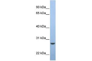 WB Suggested Anti-C15orf24 Antibody Titration:  0. (Emc7 anticorps  (Middle Region))