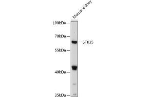 Western blot analysis of extracts of Mouse kidney, using STK35 antibody (ABIN7270225) at 1:1000 dilution. (STK35 anticorps  (AA 190-380))