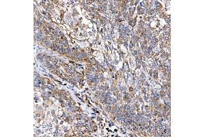 IHC analysis of RAB7/RAB7A using anti-RAB7/RAB7A antibody (ABIN7600597). (RAB7A anticorps  (AA 21-177))