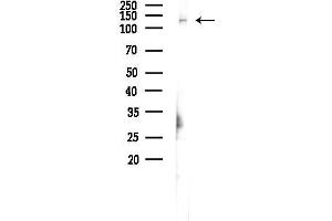 anti-Ubiquitin Specific Peptidase 36 (USP36) (Internal Region) antibody