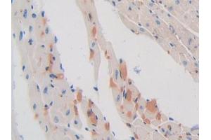 DAB staining on IHC-P; Samples: Mouse Heart Tissue